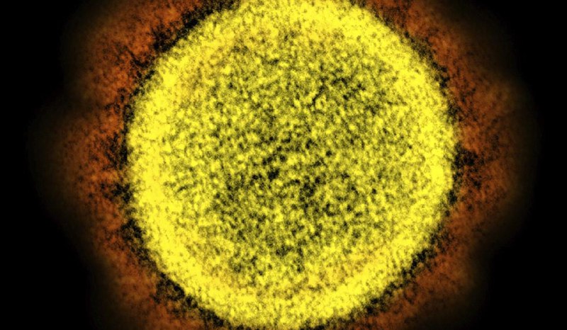 Task force on virus origin deadlocked